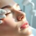 facial vein treatments