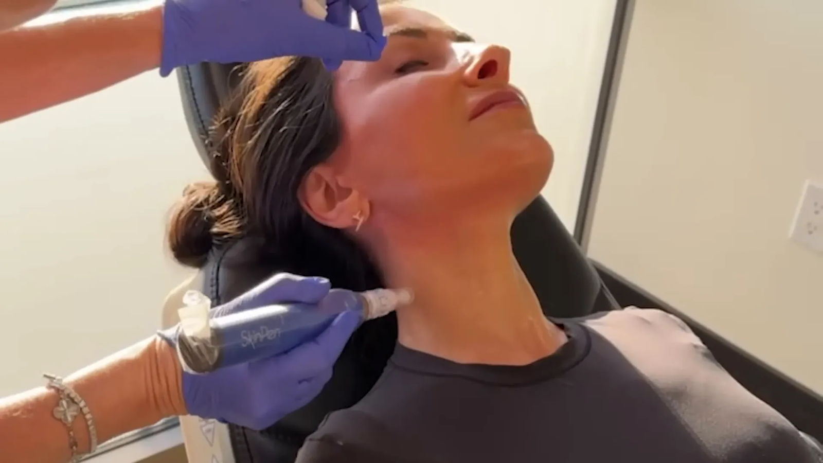 מיקרונידלינג בעור