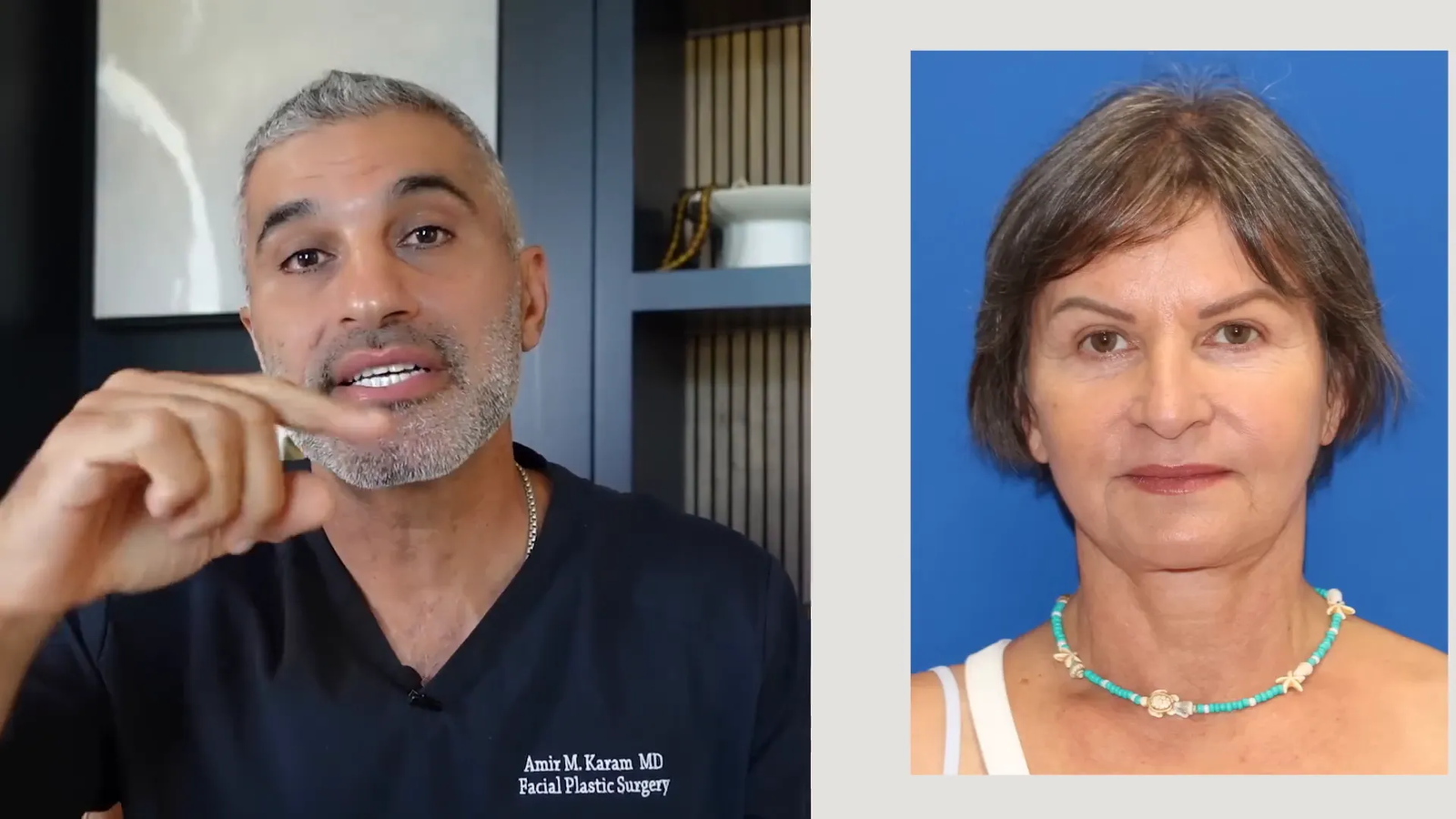 הדגמת הרמוניה בפנים