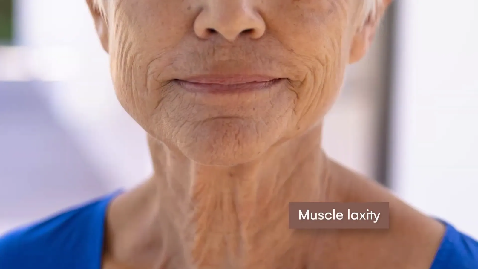 השפעות הגיל על הפנים